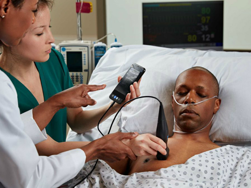 Kini smartphone bisa dijadikan alat pemindai ultrasonografi