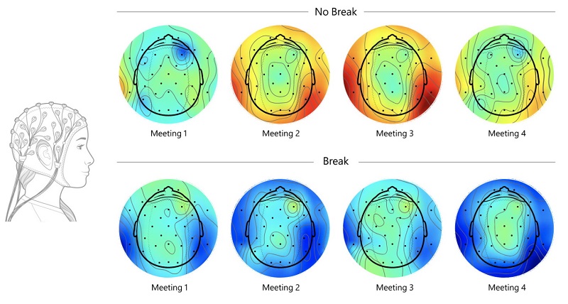 kondisi otak jika terlalu sering malakukan panggilan video