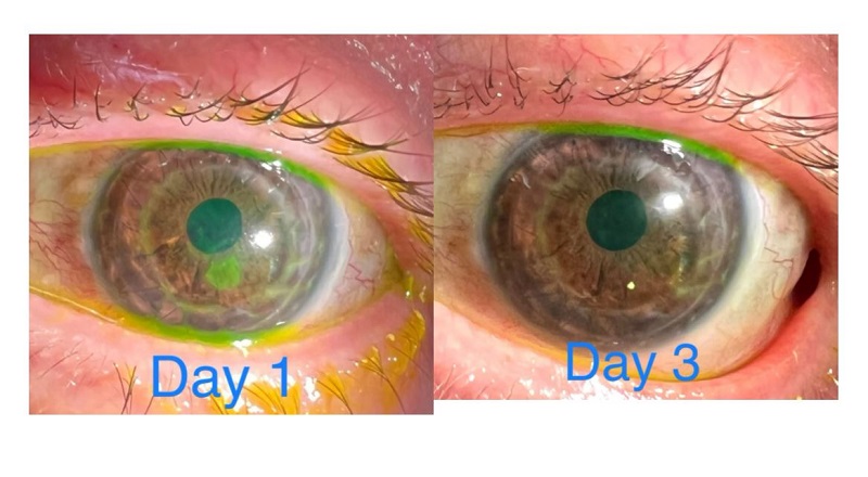 Dokter ini pakai kamera iPhone 13 Pro Max untuk periksa mata