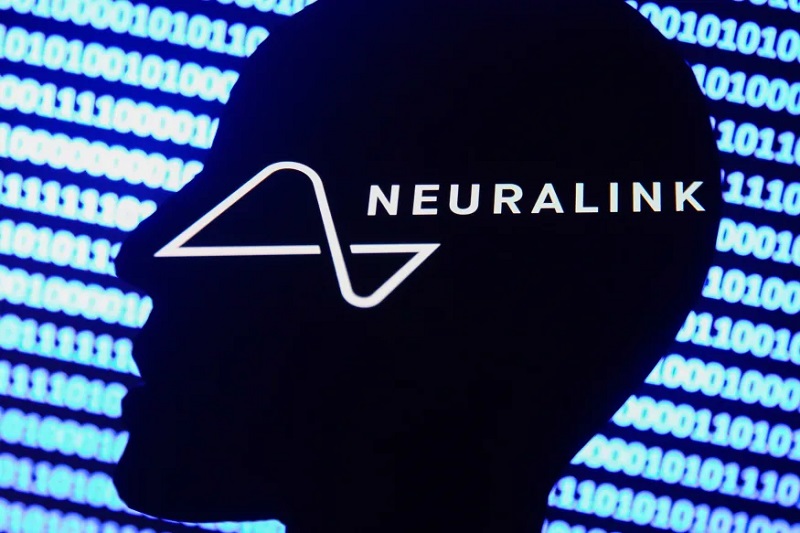 Neuralink segera lakukan uji coba pada manusia