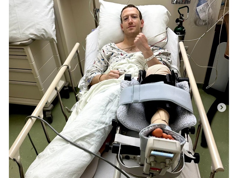 Mark Zuckerberg cedera hingga operasi gegara latihan MMA