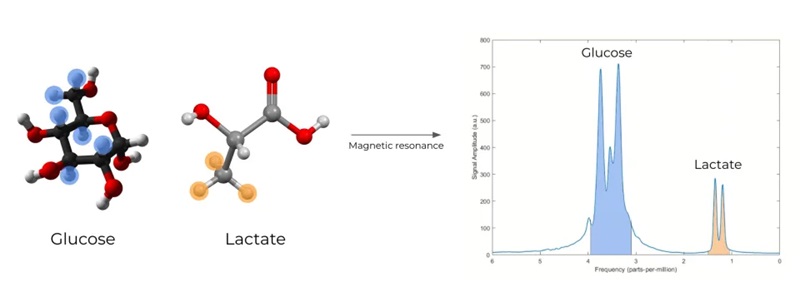 Peneliti gunakan medan magnet untuk pantau gula darah